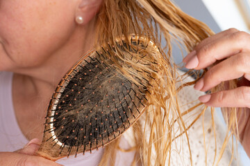 Closeup of mature woman brushing wet tangled hair with visible hair loss. Realistic aging and haircare concept for medical, cosmetic or wellness use.