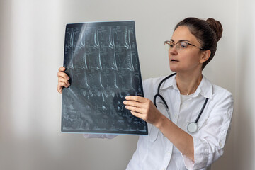 Female Doctor Analyzing Patient's MRI X-ray Scan. Medical Diagnosis and Professional Expertise....
