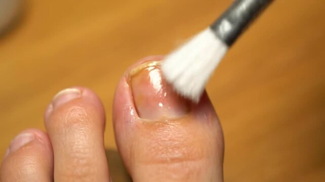 Close-up of Toe Nail Treatment Application with Cotton Swab on Warm Wood Background