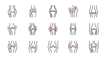 Knee pain and arthritis icon set. Vector illustration of joint inflammation, arthrosis, and bone disease. Medical anatomy for orthopedics, rheumatology, and health concepts.