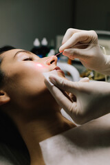 Aesthetic laser removal of nevi and benign growths. Dermatologist performs precise laser removal of...