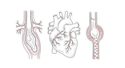 Illustration showing human heart and blood vessels with aneurysms