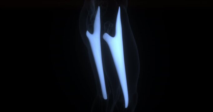 Tensor fasciae latae muscle in human body. X Ray. Loop