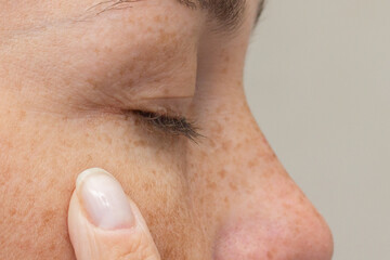 Woman with closed eye touching area showing fine lines