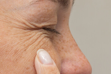 Smiling woman with closed eyes touching skin near eye with fine lines