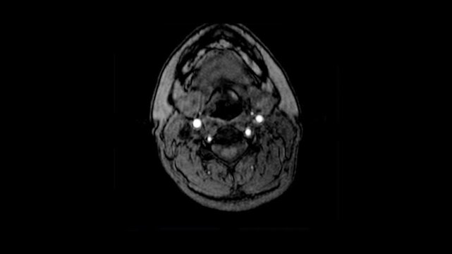 brain scan mri or brain x-ray images by ct scan or mri scanner. above view.