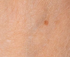 Skin mole spot closeup. Human birthmark, nevus macro texture