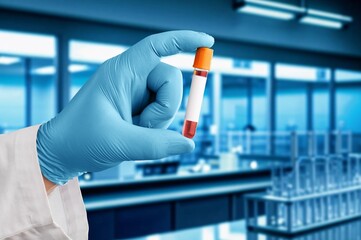 Scientist, hands hold blood test in laboratory