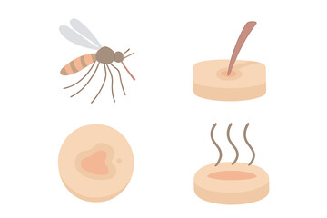 Mosquito Bite Illustration. Isometric vector illustration set mosquito proboscis bite itch: insect hovering mid-air, extended