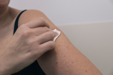 Unrecognizable woman cleaning her arm with a disinfectant wipe after receiving a vaccine injection