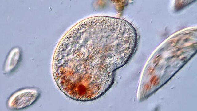High Definition Video of Ciliate Protozoa,  400x magnification 