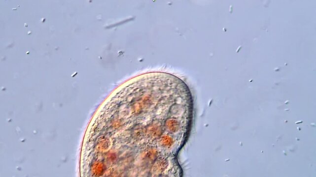Vibrant Micro Life &ndash; Ciliates Protozoa in Motion 400x