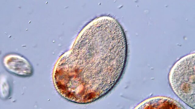 Fascinating Ciliates Protozoa Observed in Microscopy View 400x