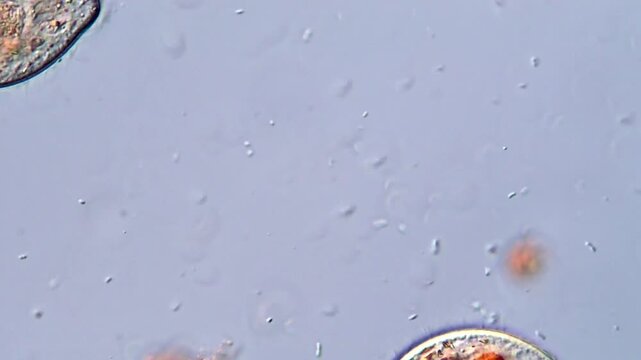 Ciliate Protozoa Under DIC Microscopic view 