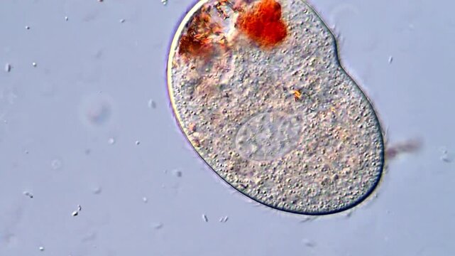 Ciliophora Protozoa Moving in Water Drop,  DIC microscope view 