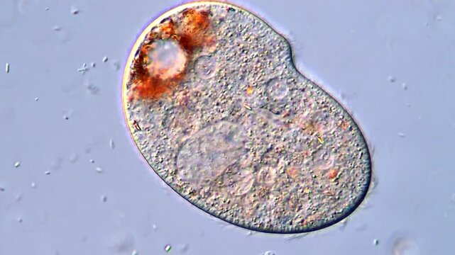 Close-Up Observation of Ciliophora Protozoa under DIC microscopy 