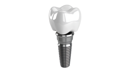 Modern dental implant model showcasing restorative dentistry options, a clean aesthetic for advertisements related to oral health and cosmetic procedures isolated on white or transparent png.