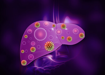 Human liver infection by hepatitis viruses. 3d illustration