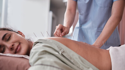 Close-up shot of physiotherapist's hand, acupuncture treatment to Latin woman patient, healing...