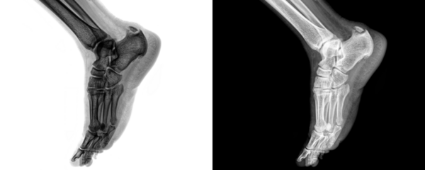 Medical Radiograph of Ankle Joint Lateral View Demonstrating Skeletal Framework and Bone Anatomy for Fracture Detection Isolated on Transparent Background