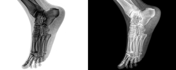 Lateral Projection X-Ray of Human Ankle Joint Showing Bone Anatomy and Skeletal Structure Isolated on Transparent Background for Medical Use