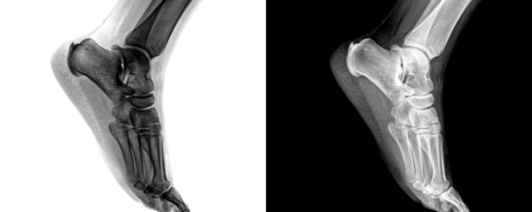 Ankle Joint X-Ray in Lateral View Displaying Skeletal Alignment and Bone Structure Isolated on Transparent or White Background for Medical Education and Research