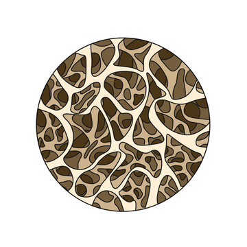 Illustration of osteoporosis, low bone density, Vector for medical, clinical, or educational posters.