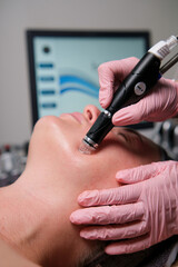 Woman undergoing a specialized microneedling treatment on her hydrated face at a modern cosmetology clinic, promoting skin rejuvenation and improving texture