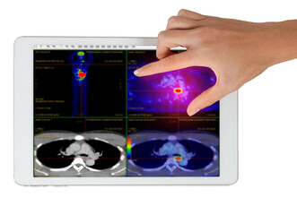 Hand interacting with tablet displaying PET/CT scans. Multiview diagnostic imaging highlights abnormal metabolic activity. Ideal for medical, oncology, and tech-related visuals.