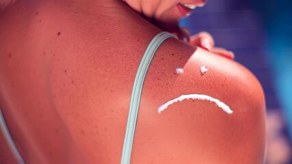 sunburned shoulder with sad face drawn in sunscreen under summer sunlight symbolizing skin protection and sun exposure awareness