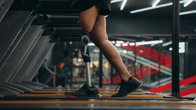 A motivated woman with a prosthetic leg walking on a treadmill in a modern gym, representing fitness, rehabilitation, and strength with a positive attitude towards an active healthy lifestyle.