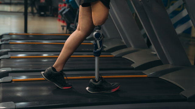 A motivated woman with a prosthetic leg walking on a treadmill in a modern gym, representing fitness, rehabilitation, and strength with a positive attitude towards an active healthy lifestyle.
