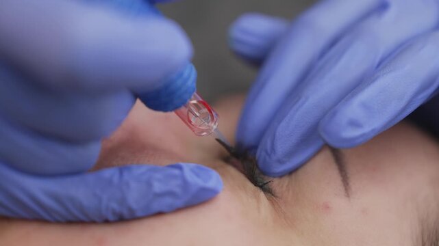 Beautician performing permanent eyeliner makeup on woman's eyelid
