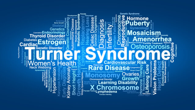 Turner Syndrome Word Cloud. Key Concepts On X Chromosome Abnormality, Female Development, Infertility, Hormonal Therapy, And Genetic Health Awareness.