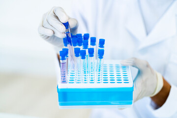 Female researcher with test tubes in microplate at laboratory