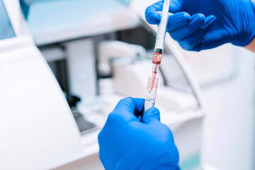 Hands of doctor analyzing blood sample at laboratory