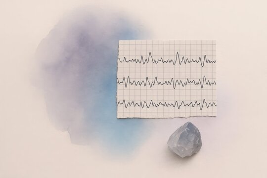 Holistic Mind-Body Balance. An abstract collage of a heartbeat chart, healing crystal, and watercolor splash. A concept for holistic health, mindfulness, and spiritual wellness.