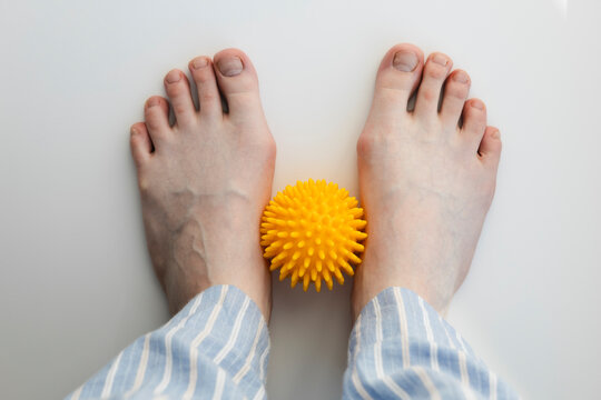 Female feet with flatfoot and bunions using massage ball on white background.