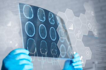 Medical professional analyzing brain scans with digital overlay of health data in a clinic setting
