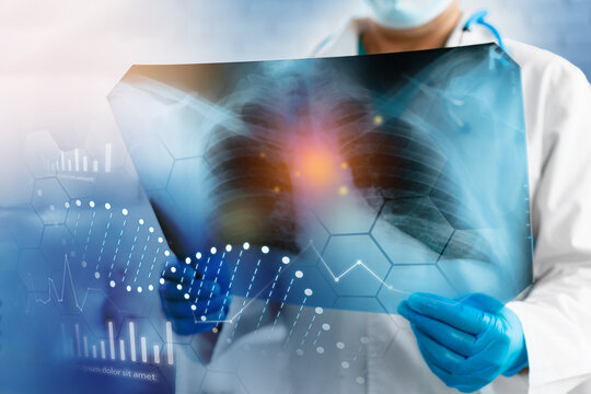 Doctor examines chest X-ray with digital health data overlay in medical facility