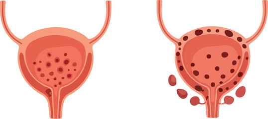 Urinary System Bladder Icon - Anatomy Vector Design-medical poster- internal organs vector - urinary  organ icon