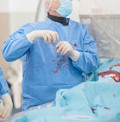Medical professionals engage in a critical procedure utilizing advanced microsphere technology for targeted cancer treatment