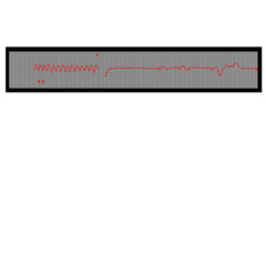 vector illustration of a heart monitor