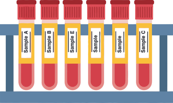 Six labeled blood samples in test tubes, placed in a blue rack.