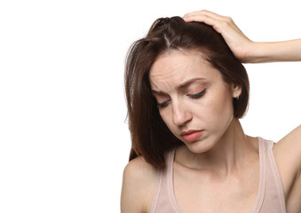 Fototapeta premium Woman with hair loss problem on white background