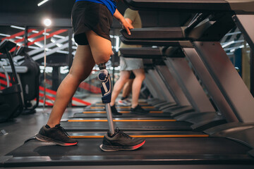 A motivated woman with a prosthetic leg walking on a treadmill in a modern gym, representing fitness, rehabilitation, and strength with a positive attitude towards an active healthy lifestyle.