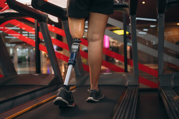 A motivated woman with a prosthetic leg walking on a treadmill in a modern gym, representing fitness, rehabilitation, and strength with a positive attitude towards an active healthy lifestyle.