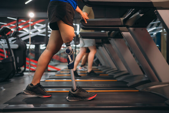 A motivated woman with a prosthetic leg walking on a treadmill in a modern gym, representing fitness, rehabilitation, and strength with a positive attitude towards an active healthy lifestyle.