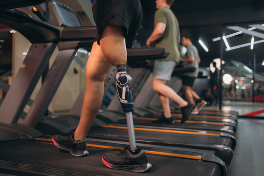 A motivated woman with a prosthetic leg walking on a treadmill in a modern gym, representing fitness, rehabilitation, and strength with a positive attitude towards an active healthy lifestyle.