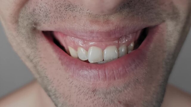Extreme close-up on a man's mouth with stubble breaking into a wide, joyful smile. The shot shows his upper and lower teeth, some crooked, and his gums, conveying genuine happiness and amusement.
